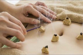 accupuncture