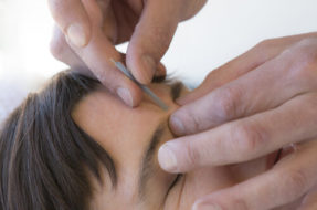 canberraacupuncture