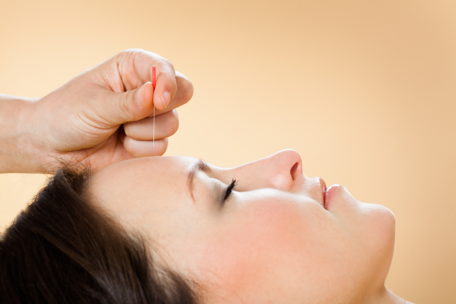 how-acupuncture-can-help-with-your-body